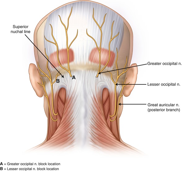 occipital_nerves
