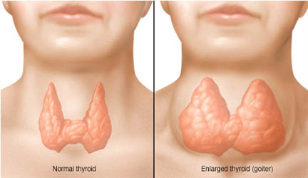 thyroid gland