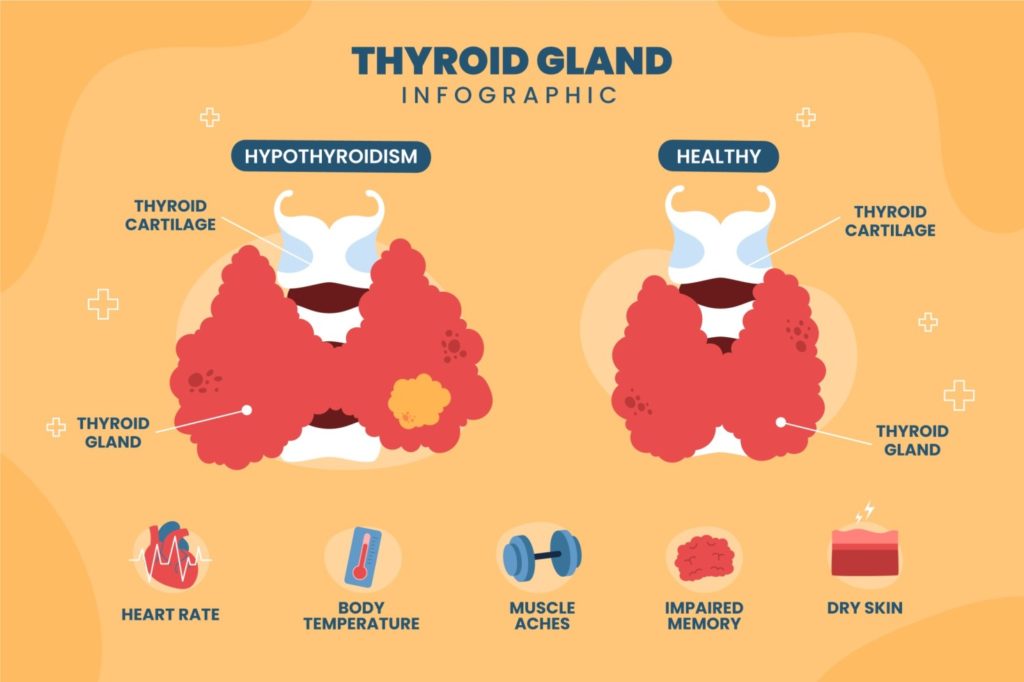 thyroid gland infection